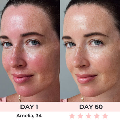 Selinaskin™ - LED Face Mask